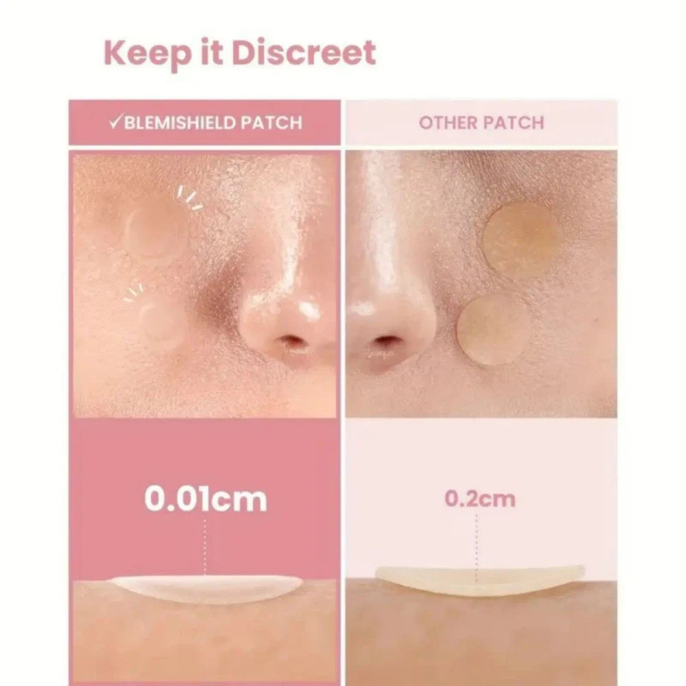 Ultra-Thin Star Acne Patches