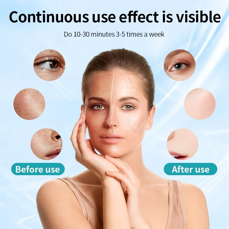 Wireless LED Light Therapy Face Mask